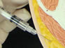 Subcutaneous Injections