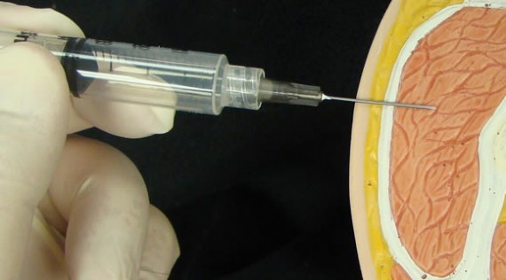 Intramuscular injection